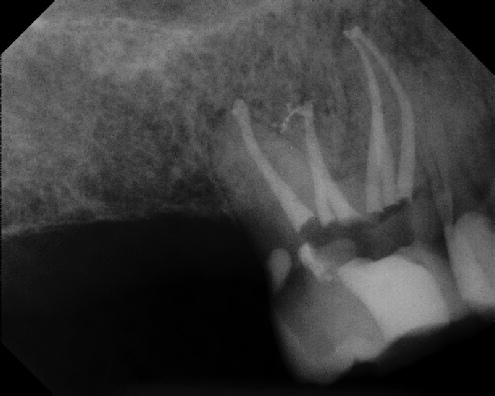 Root Canal Anatomy - Stratford