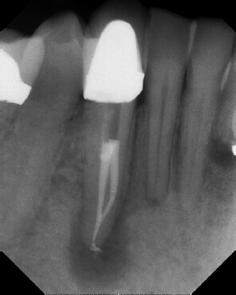 Root Canal Anatomy - Stratford