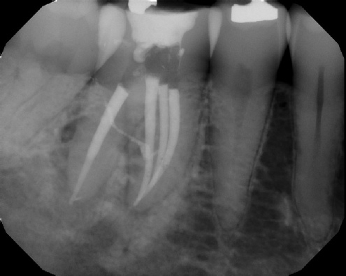 Root Canal Anatomy - Stratford