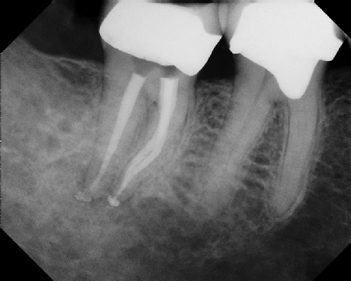 Root Canal Anatomy -Stratford